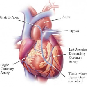 Cardiology