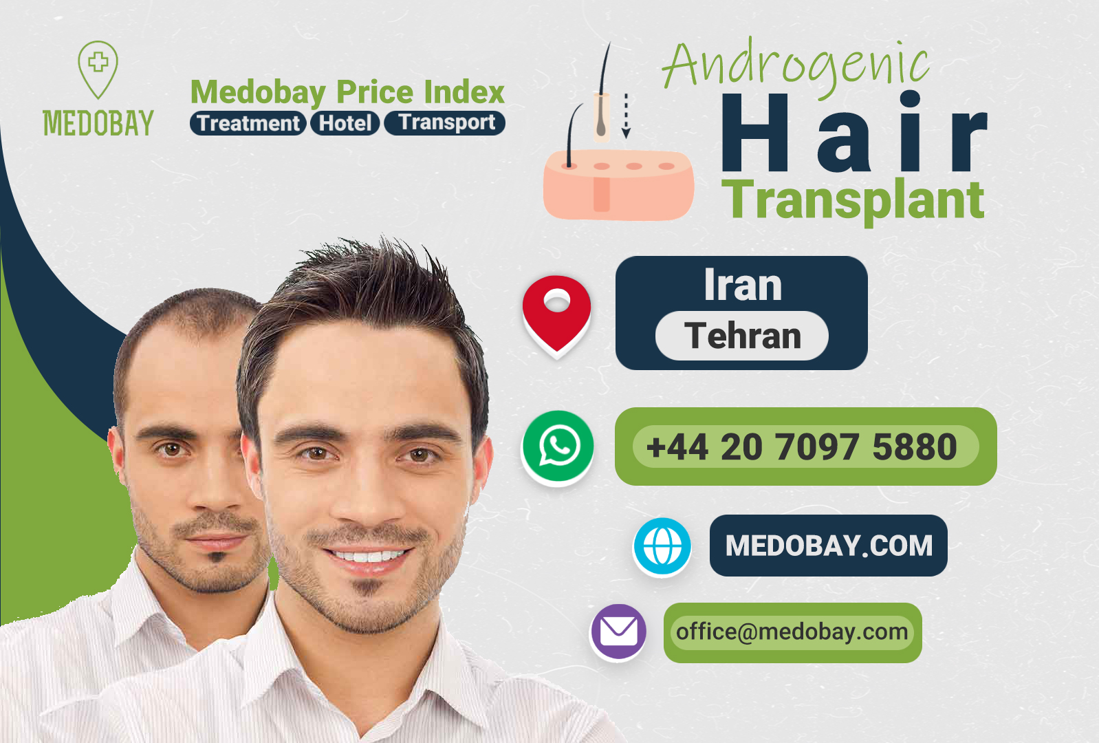 Androgenic Hair Transplant Tehran