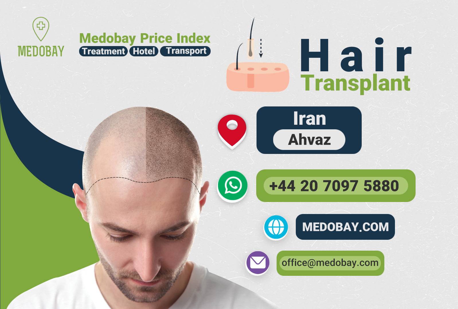 Hair Transplant Ahvaz