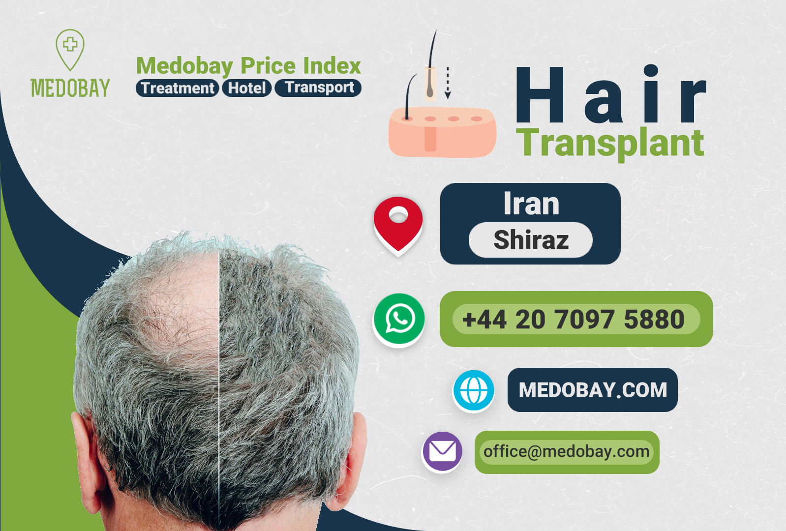 Hair Transplant Shiraz