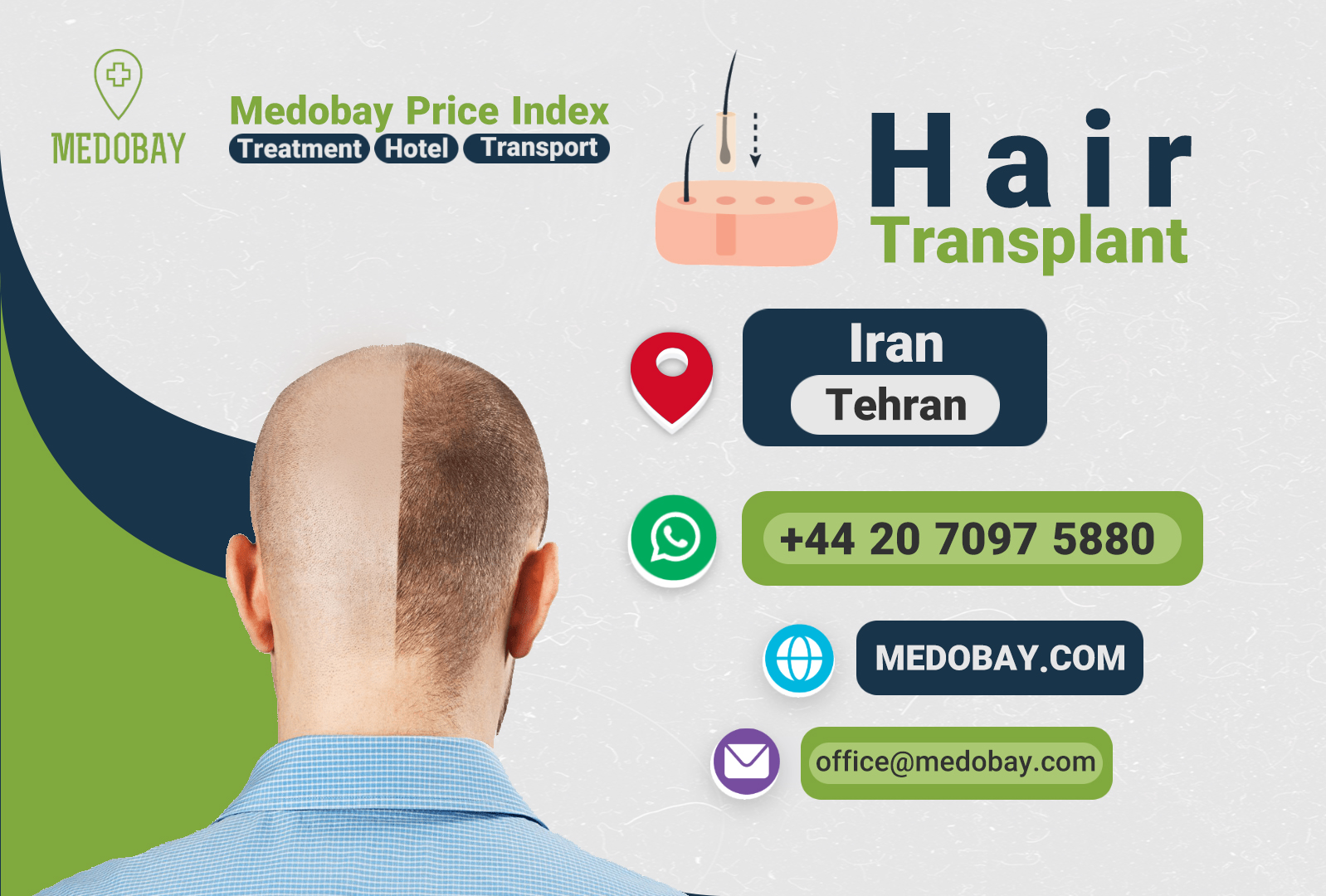 Hair Transplant Tehran 