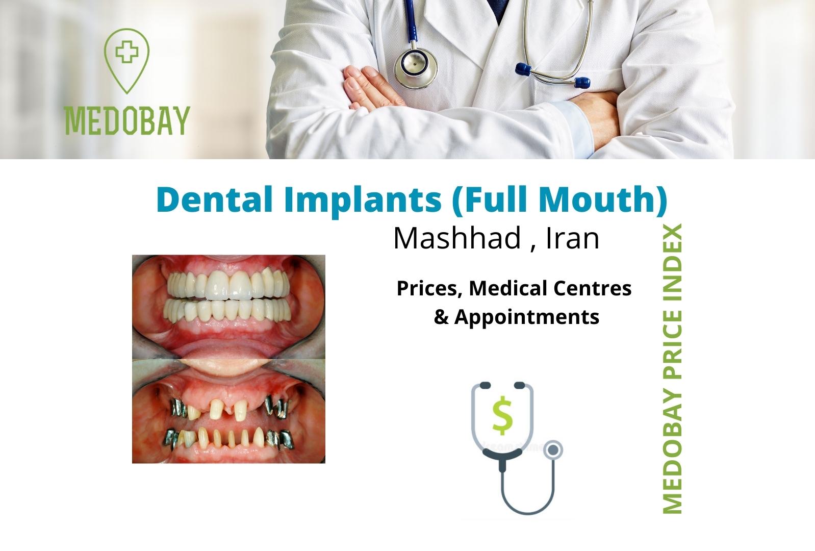 full mouth dental implant mashhad