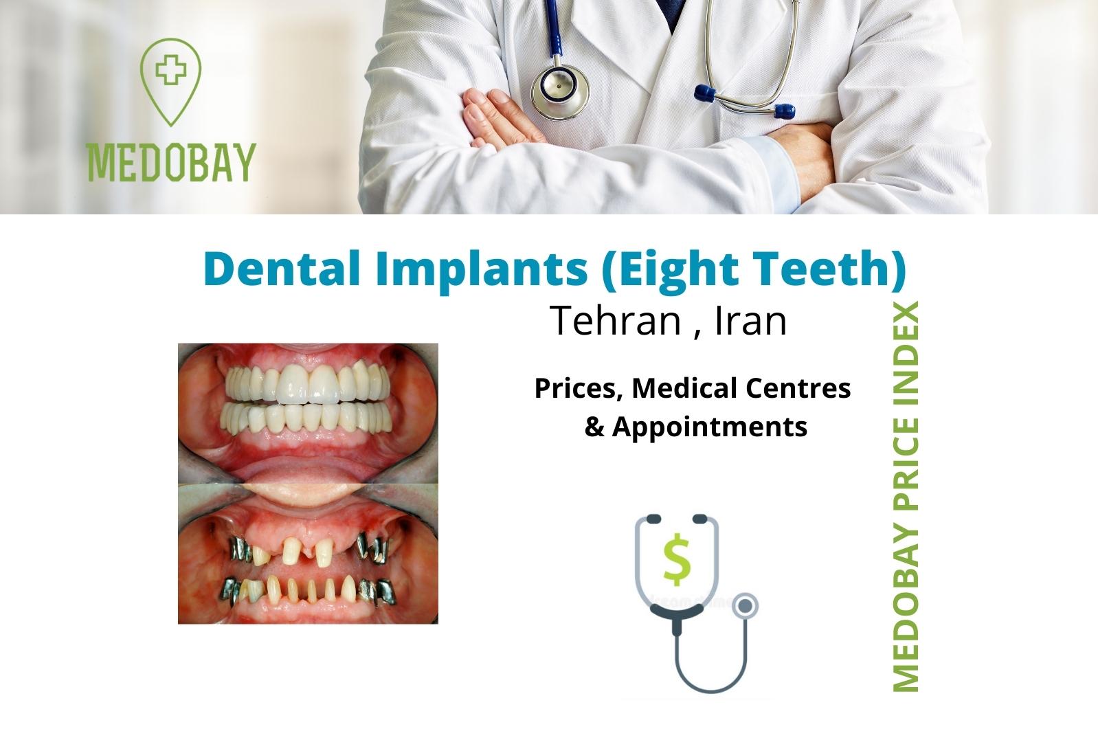 eight teeth dental implant tehran