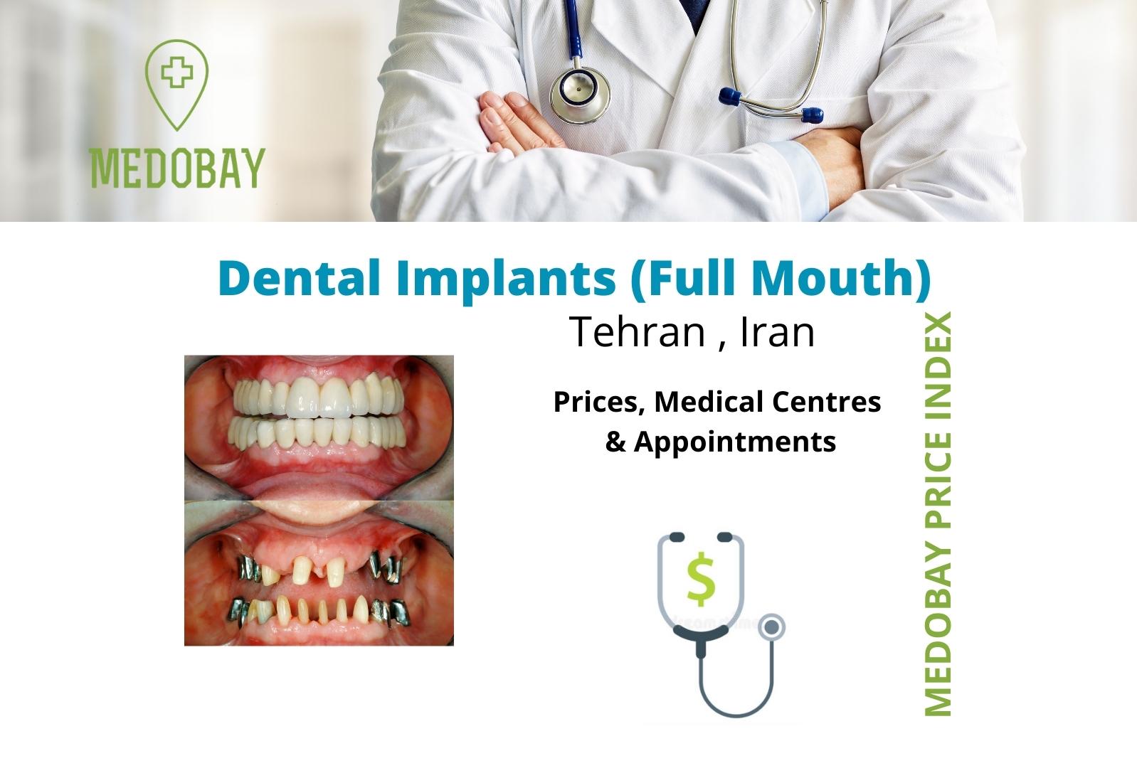 full mouth dental implant tehran